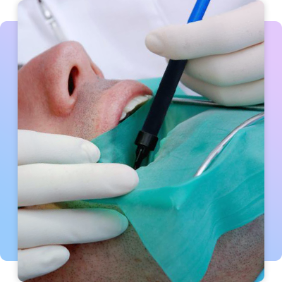 How does root canal work